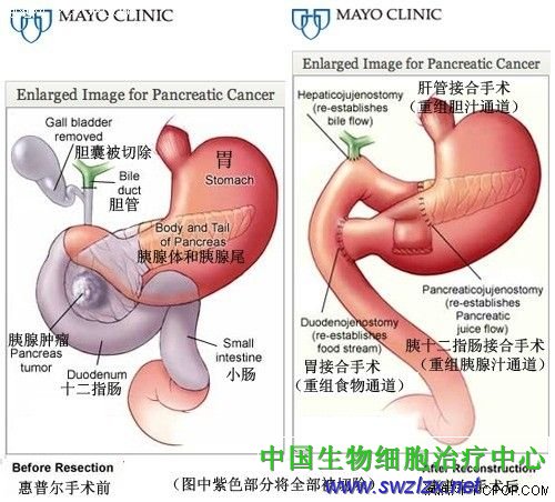 八年抗争史 乔布斯与